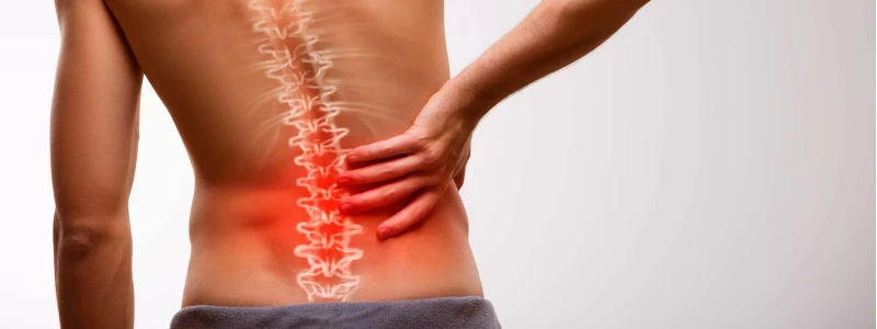 Dor irradiada causada pela coluna