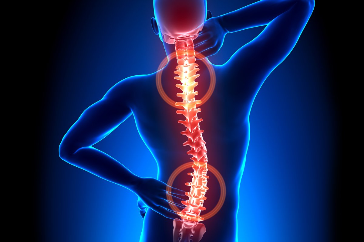 Paciente com dor irradiada da coluna